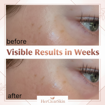 Before After Cheek